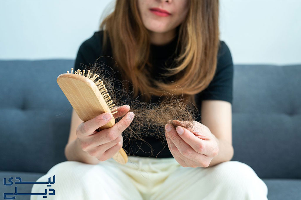 تاثیر استرس بر ریزش مو