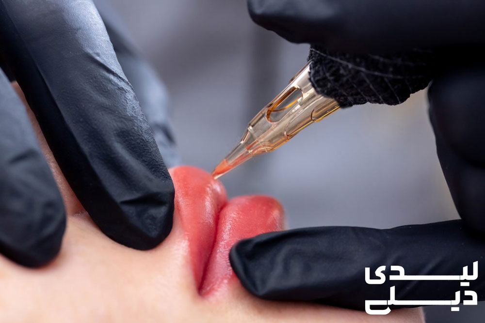 آیا شیدینگ لب درد دارد؟