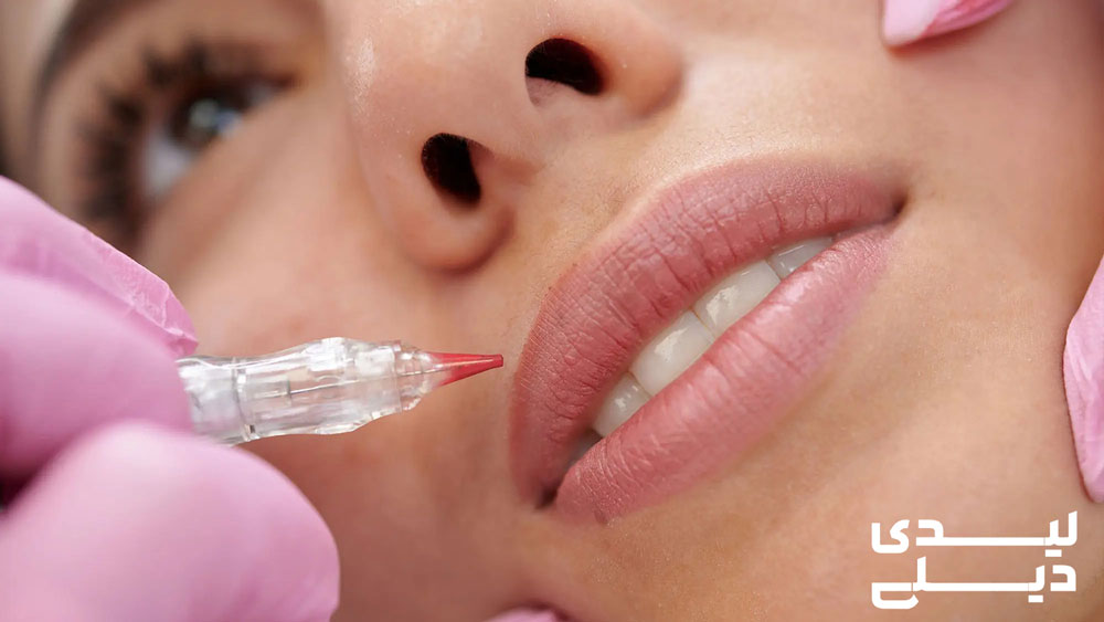 آیا شیدینگ لب نیاز به ترمیم دارد؟